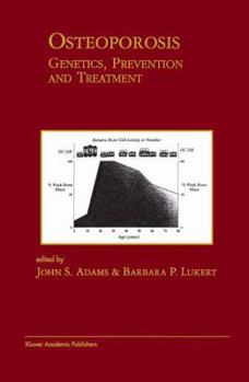 Paperback Osteoporosis: Genetics, Prevention and Treatment: Genetics, Prevention and Treatment Book